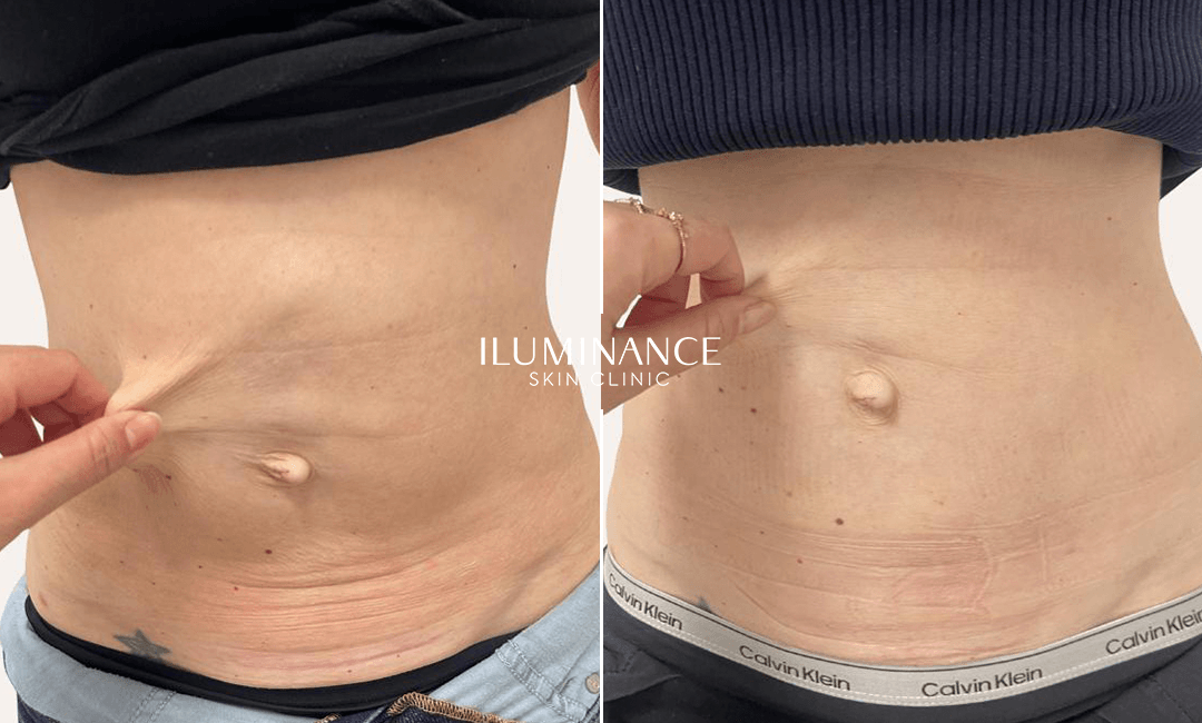 Collagen Lenisna - 27