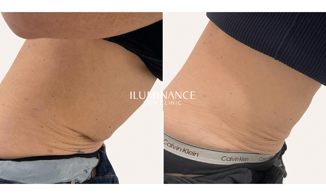 Collagen Lenisna - 29